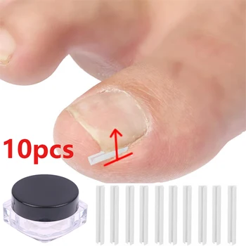 Наклейки для коррекции ногтей 10 шт., Пластыри для коррекции вросших ногтей, Пластыри для восстановления паронихии, Инструменты для педикюра